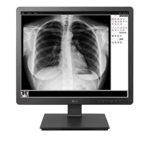 LG 19HK312C monitor de ecrã 48,3 cm (19") 1280 x 1024 pixels SXGA